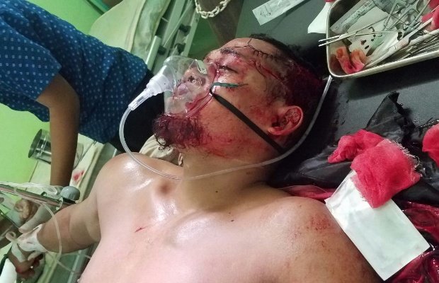 Foto: Salah satu korban carok satu lawan tiga di kangean