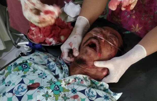 Foto: kakek tewas tabrak pot