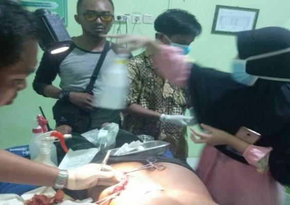Foto: Korban pembacokan di Kangean