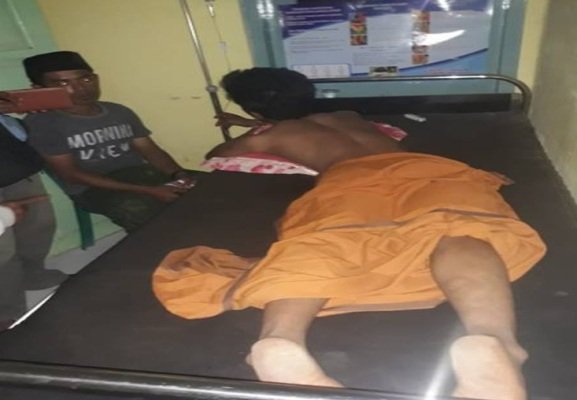 Foto: Korban Pembacokan Kangean saat menjalani perawatan medis di puskesmas