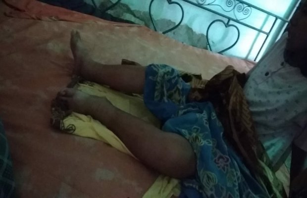 Foto: Kondisi Anita Terbaring Lemas Di Tempat Tidurnya