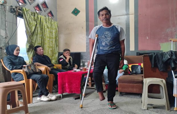 Foto: Nurjamat, warga Jalan Cempaka, RT 3, RW 6, Desa Pesanggrahan, Kecamatan Batu, Kota Batu yang membutuhkan bantuan berupa kaki palsu.