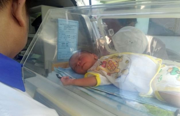 Foto Bayi Tanpa Anus