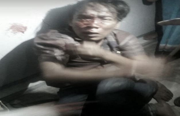 Foto Pencuri saat Dikroyok Massa