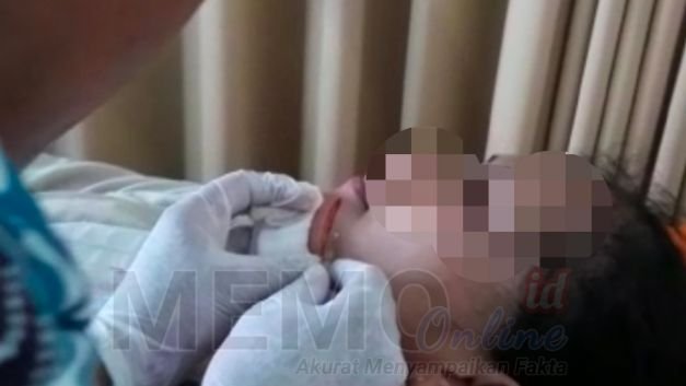 Foto : NH inisial saat dirawat di Klinik Sabilillah Sampang 