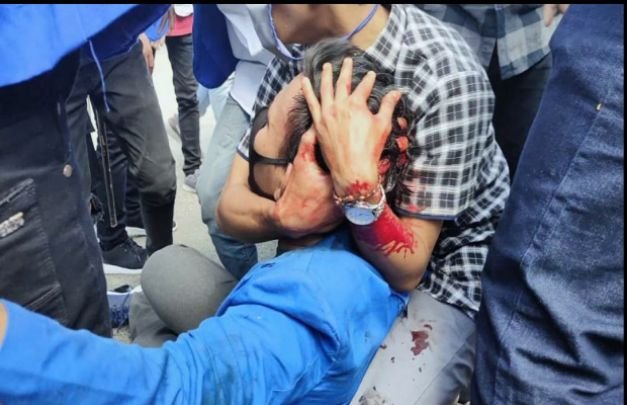Foto: salah satu massa aksi PMII Cabang Pamekasan yang mengalami luka dibagian kepalanya