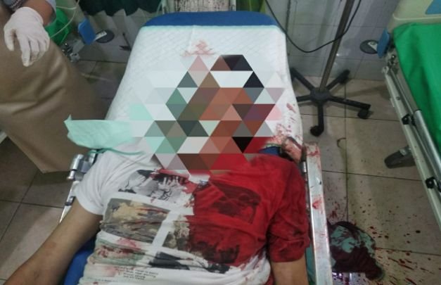 Foto : Korban Kecelakaan.