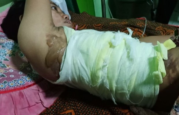 Foto: Suryani si istri penjual pentol saat menjalani perawatan medis di puskesmas