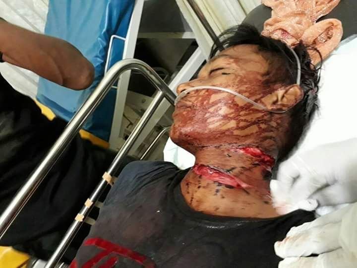 Foto: Korban Saat Menjalani Perawatan Medis