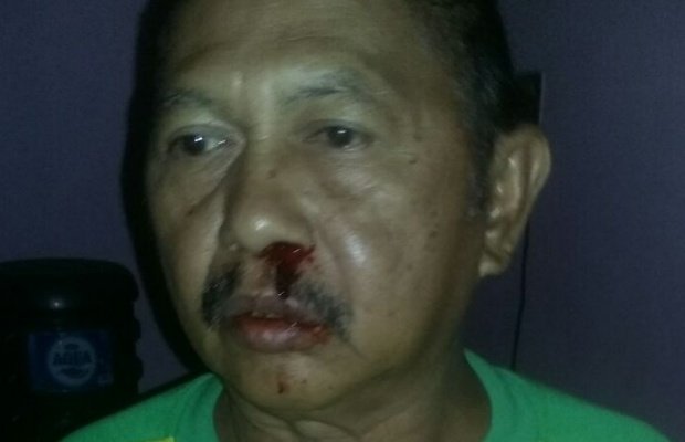 Foto: Korban pemukulan tetangganya sendiri di Bondowoso