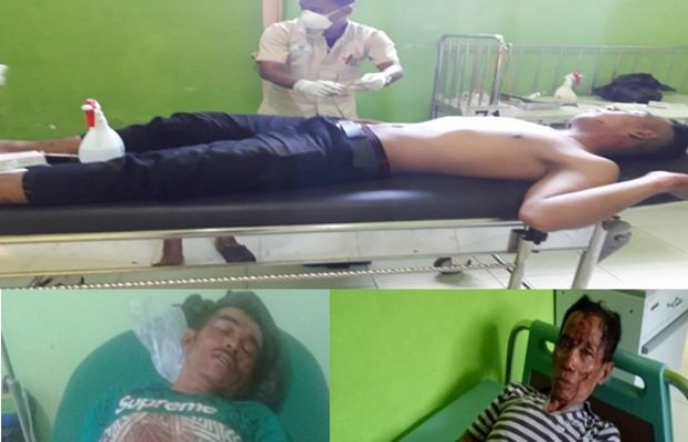 Foto: Korban perkelahian atau carok saat dirawat di puskesmas kangean