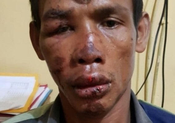 Foto: Sukirman babak belur di hakimi massa