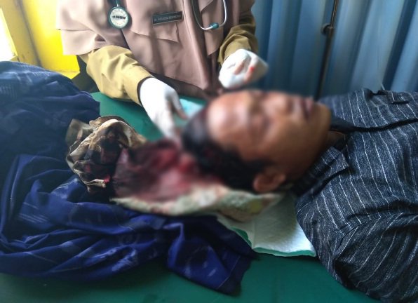 Foto: Korban pembacokan di Pasongsongan