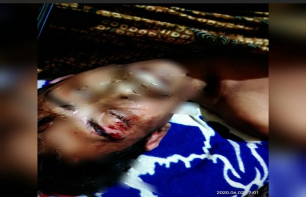 Foto: Liman, warga Arjasa Kangean yang hingga kini penyebab kematiannya hingga kini masih misterius