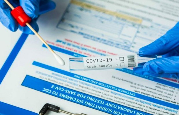 Foto : Ilustrasi Rapid Test Antigen