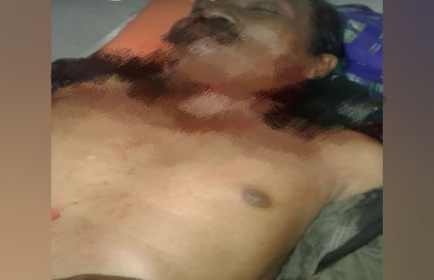 Foto : Korban Misran / P. Devi Warga Desa Tegalrejo, Kecamatan Mayang, Jadi Tontonan Warga.