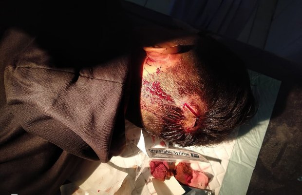   Foto : Kondisi tubuh korba usai di sabit sebilah clurit.