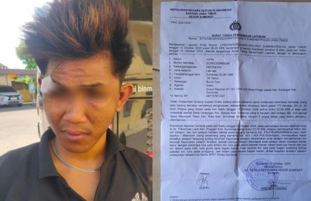 Foto: Kondisi korban saat melaporkan peristiwa pengeroyokan ke Mapolres Sumenep