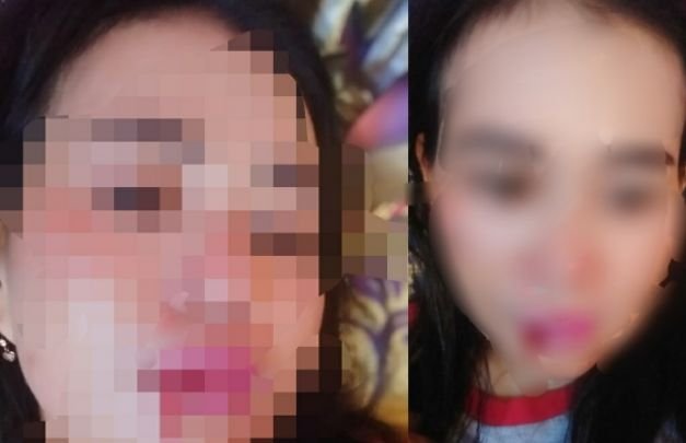 Foto: korban KDRT di Sampang