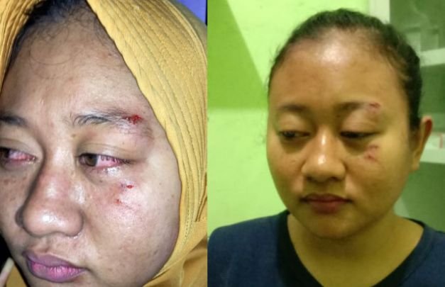 Foto: korban penganiayaan pelakor di sumenep