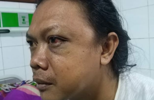 Foto: Kholik, wartawan Bongkar 86 yang menjadi korban pengeroyokan preman